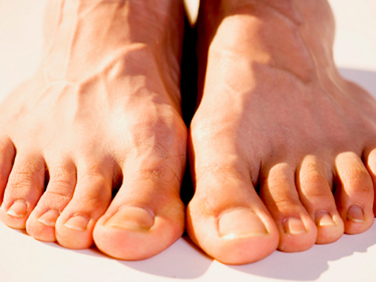 feet fongus
